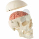 Lebka muže s mozkem rozložitelným na 8 částí